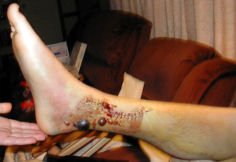 Illustration for article titled Hope You've Already Had Lunch: A Blood Week Blood Writes Gallery To Close Out Blood Week